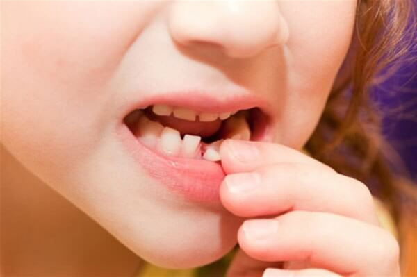 جدی و مهم در خصوص دندان شیری کودکتان