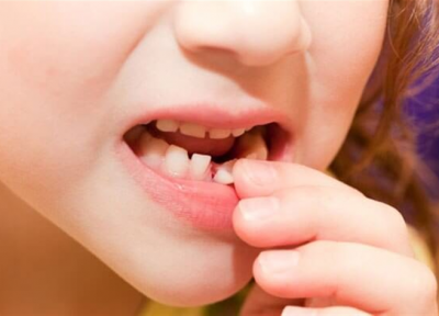 جدی و مهم در خصوص دندان شیری کودکتان